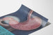 Anatomical Poster of the Pylorus and Stomach - Medical Wall Decoration