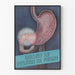 Anatomical Poster of the Pylorus and Stomach - Medical Wall Decoration